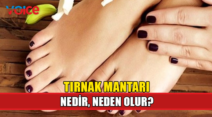 Tırnak mantarı nedir, neden olur?