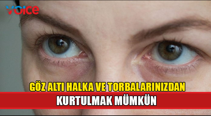 Göz altı halka ve torbalarınızdan kurtulun!