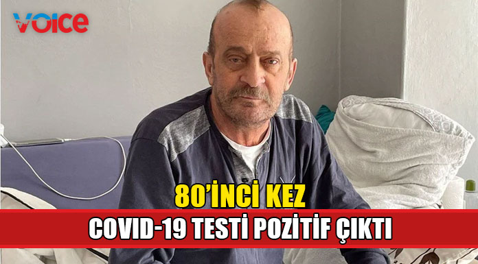 "Dünya literatüründe çok örneği yok"