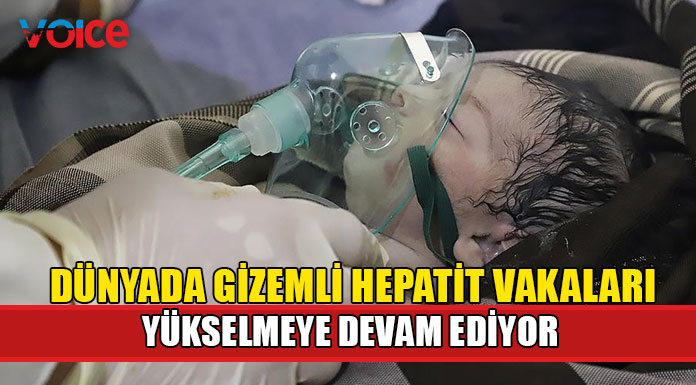 18 çocuk karaciğer iflasına uğradı