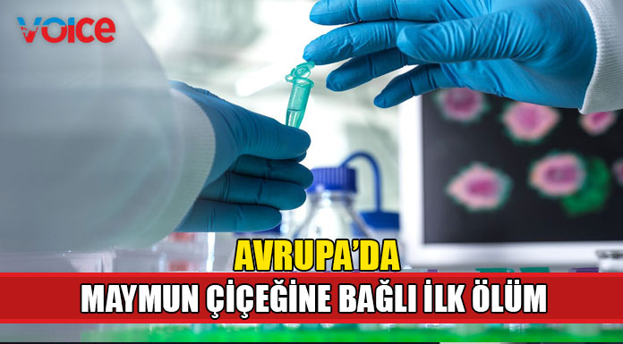 İspanya, Avrupa’da maymun çiçeği virüsüne bağlı ilk ölümü açıkladı