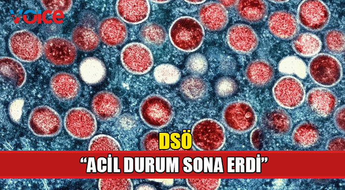 DSÖ'den maymun çiçeği açıklaması