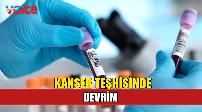 Üç kanserden ikisini tespit etti